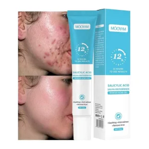 Pimple Scar Glycerin Niacinamide Salicylic Acid Anti Spots Removal Gel Shrink Pores Cream