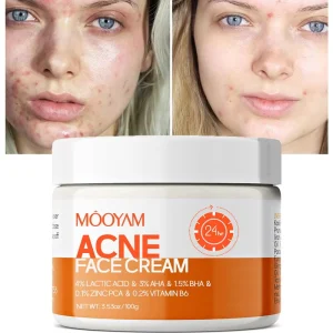 Private Label OEM Oil Control BHA Salicylic Acid Acne Face Cream